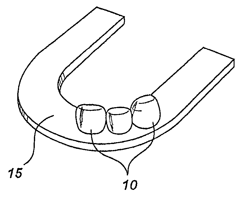Patent US20060154211 - Prefabricated pediatric crowns and method 