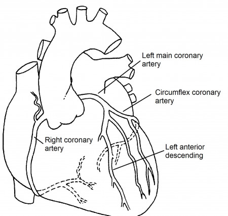 Interventional Cardiology Services — Harrison Heart & Vein